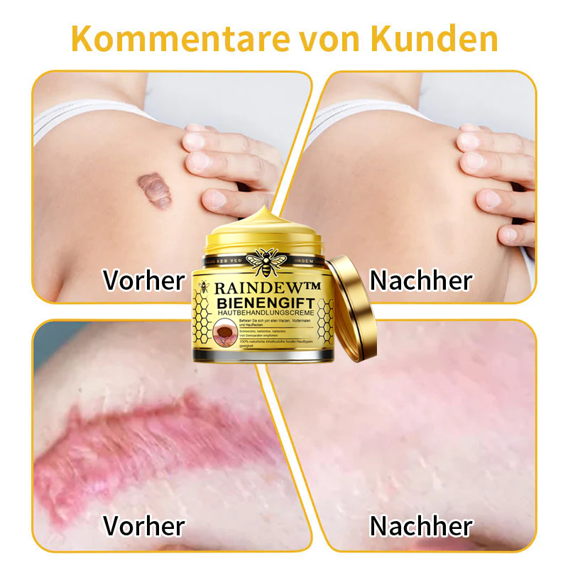 [Winter-Hautpflege] Raindew™Bienengift-Hautpflegecreme (AAD Empfohlen)