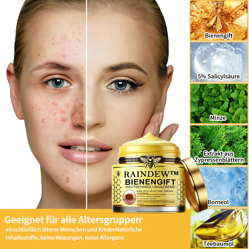 [Winter-Hautpflege] Raindew™Bienengift-Hautpflegecreme (AAD Empfohlen)