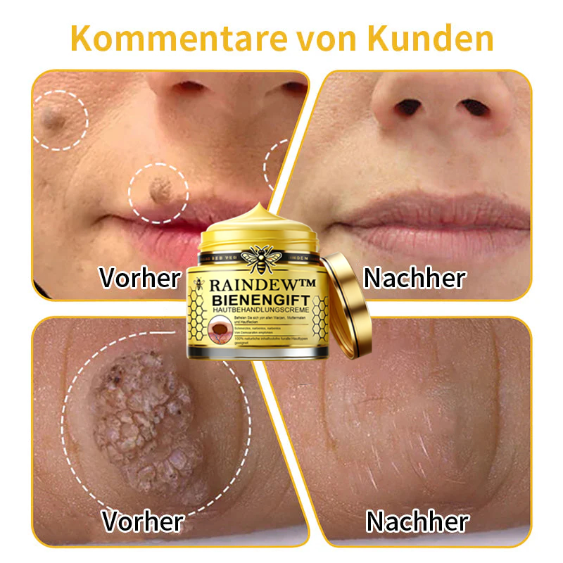 [Winter-Hautpflege] Raindew™Bienengift-Hautpflegecreme (AAD Empfohlen)