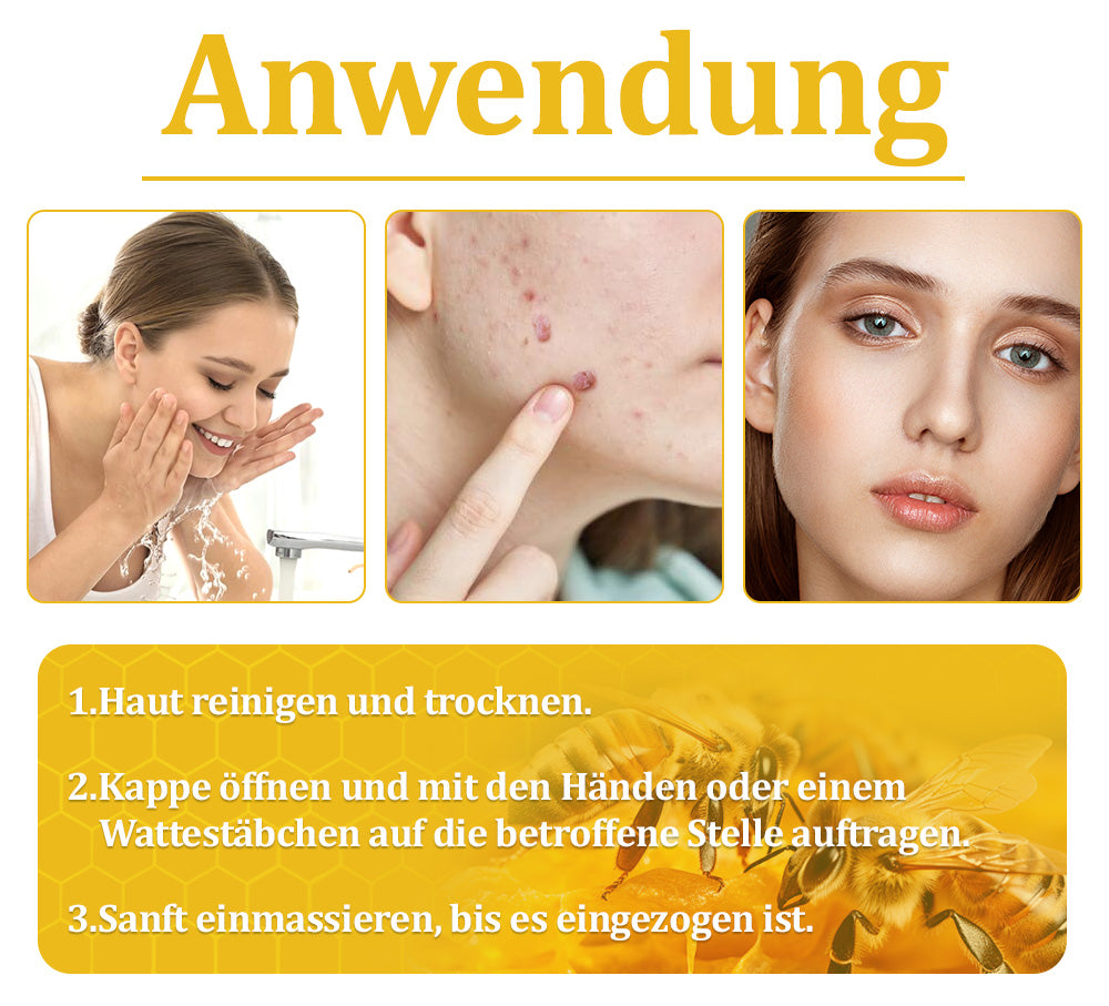 ✅Offizieller Store: 🐝Turonu™ Bienengift Multitherapie-Creme(🧑‍⚕️Dermatest-Zertifizierung)