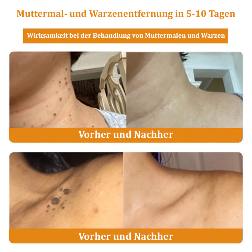 ✅Offizieller Store: 🐝Turonu™ Bienengift Multitherapie-Creme(🧑‍⚕️Dermatest-Zertifizierung)