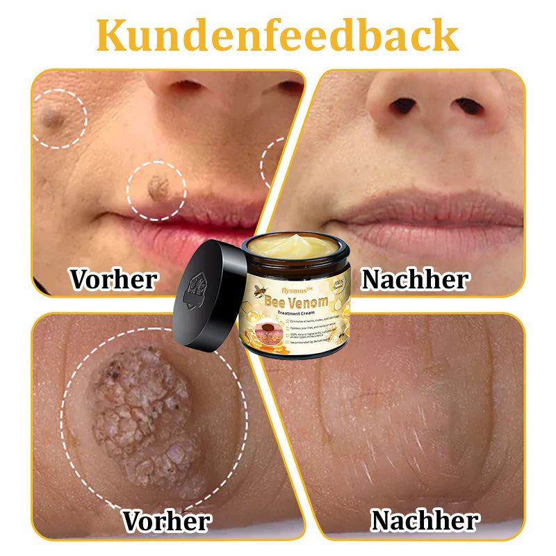 ✅Offizieller Store: 🐝Turonu™ Bienengift Multitherapie-Creme(🧑‍⚕️Dermatest-Zertifizierung)