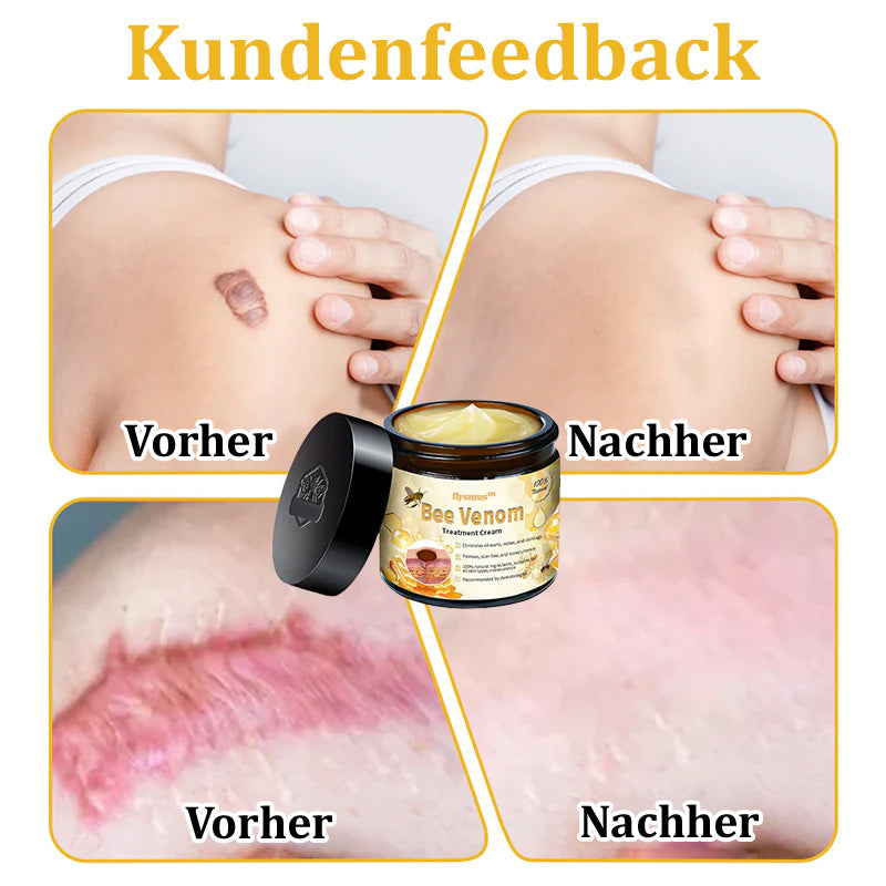 ✅Offizieller Store: 🐝Turonu™ Bienengift Multitherapie-Creme(🧑‍⚕️Dermatest-Zertifizierung)