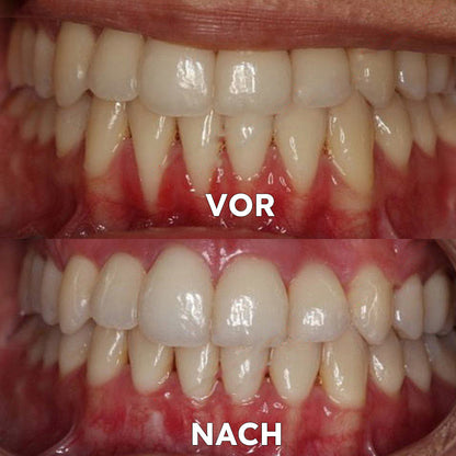 ✅BMEL-Zulassung |Ourlyard™ Kokosöl-Mundspülung mit ätherischem Öl